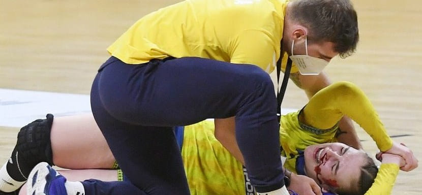 Черногорке Иване Годец из словацкой "Ювенты" разбили лицо в матче с чешским "Баником". Причиной кровотечения мог быть ботокс (ВИДЕО)