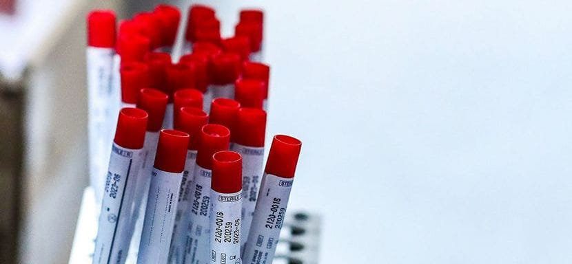 Бундеслига. Во "Фленсбурге" зафиксирована вспышка коронавируса. Вечерняя встреча с "Ганновером" отменена