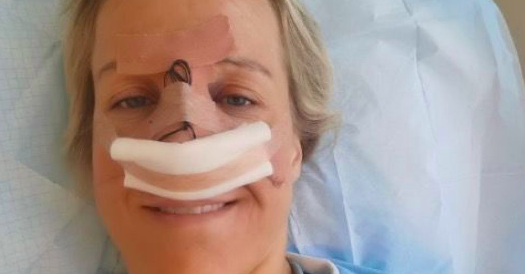 Норвегия. Хейди Леке прооперировали травмированный нос — у нее было семь переломов