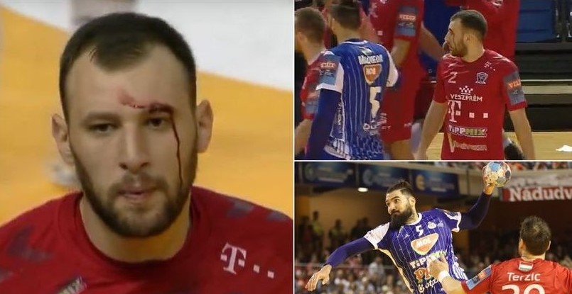 Кубок Венгрии. Деяну Манаскову рассекли бровь в финальном матче (ВИДЕО)